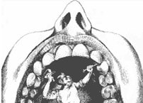 Zeichnung - Zahnarzt behandelt Zähne